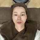 송도외과의원 | 인천 올리지오 600샷 고주파리프팅 송도 성형외과 후기