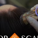 숨스칼프 이미지