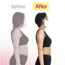 에소코핏화성 | 화성·동탄 다이어트 후기｜에소코핏 2개월 -10kg 체지방 감량 성공 스토리