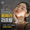 서울본탄탄의원 | 울쎄라후기 원장 시선으로 본 리프팅의 차이