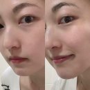 버블워시(조차형) | 남자피부관리 브리올 폼클렌징 후기 유분 많은 남성 주목