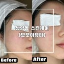 스킨테라피 | 상암 스킨케어 모모아뷰티 카복시테라피 후기 브라질리언 왁싱 잘하는곳