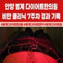 남지한의원 | 안양 범계 다이어트한의원 내돈내산 7주차 후기ㅣ폭염 속에서도 꾸준한 다이어트!