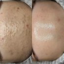 답십리5 이미지