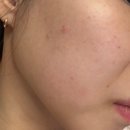 골든메디 | 저자극마스크팩 큐어토리 72샷 스킨부스터 메디팩 후기