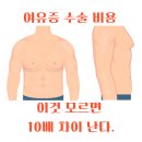 의료법인진성 | 여유증 수술 비용과 건강보험 : 이것 모르고 가면 10배 차이!