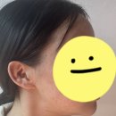 아로마루 | [평택] 숨어있는 윤곽을 찾아주는 선새김 윤곽술 후기 ㅣ 선새김에스테틱 ㅣ 윤곽관리