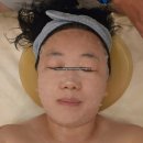 러블리현 | 포천피부관리, 러블리현에서 mts 관리 받고 왔어요!