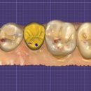 가까운치과기공소 이미지