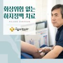 서울 하지정맥류 화상 위험 없는 하지정맥류 치료법은 이미지