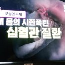 내 몸의 시한폭탄,심혈관질환/엄지의제왕/온라인수련/기수련/기치유/자연요법 이미지