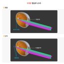 김안과의원 | 서울 영등포 건양의료재단 김안과의원 어린이 난시 원인 증상 치료 예방 방법