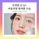 마스크성형외과의원 네이버블로그