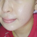 봉스킨케어 네이버블로그