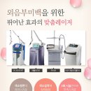 미백 티스토리