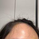 하이엔드멍