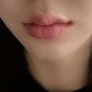 [강남역 립쥬란] 강남역성형외과 입술 리쥬란 립쥬란 후기! 붓기 / 아픔 생생 후기 💖