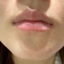 전의를디자인하는사람들 | 신사역 하이미의원 섬세한 맞춤 디자인 신사입술필러 ! 신사역 8번출구 5초거리라 너무 편해 !