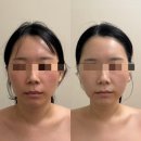 와우에스테틱 | [전남광주/서구] 화정동 윤곽관리, 리큐브에스테틱(찐찐방문후기)