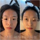스완드