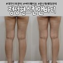 대전 웨딩관리 신부관리 잘하는 정성현스킨앤바디 써마웨이브 솔직후기
