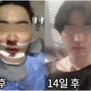 김영재치과의원 네이버블로그