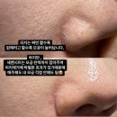 예쁠래에스테틱 네이버블로그