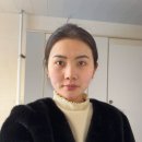 피코 레이저 딱지 1회 치료 장희빈미안법 병행 후기