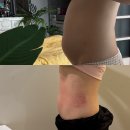 뷔에고 | 김포 복부관리 추천 뷔에고에스테틱 복부 리셋 5회차 후기