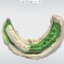 뉴치과기공소 이미지