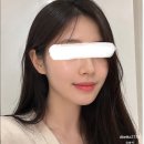 울산슈퍼 | 울산피부관리 리페어에스테틱 울산점 슈퍼맥스 관리 후기