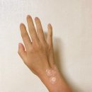 유상호정형외과의원 | 손목MRI 판독 다른 처방, DNA주사 4주차 @ 유상호 정형외과