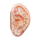 이혈요법 이미지