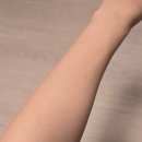 강남더블유의원 | 강남/서초 W클리닉(더블유의원) 레이저제모 5차 마지막 후기