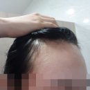 아보헤어 | 아보다필 먹고 앞머리 휑한것도 마음이 휑한것도 없어졌어요~~~