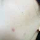 벌교맑은의원 네이버블로그