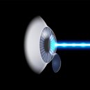 군산안과의원 이미지