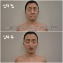 김혜자 에스테틱 | 인천 송도에스테틱 신부관리에 좋은 ‘앙보티 에스테틱’ 후기