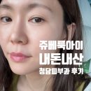 원대병원 앞(북일초등학교 방향) | 청담피부과 * 눈밑꺼짐 쥬베룩아이 스킨부스터로 해결!!(가격/통증/멍)