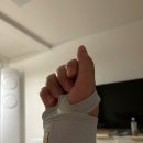 쿵수니 | [임신 24주차] 용띠 공주님 맘, 임당 검사&amp;입체 초음파 후기, 손 부음&amp;손목터널증후군