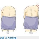 청소년기에 교정해야하는 척추측만증 증상과 자가진단법 이미지