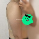 (주)산소피아 | 웨딩 DIET_팔뚝 무한람스 1주차 멍, 붓기 후기