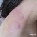 3well | 생일선물로 받은 Well247 흡입괄사 바디컷튠핏 솔직후기