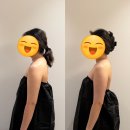 고고에스테틱 | 원주 웨딩관리 감자에스테틱 & 왁싱 뼈말라 팔뚝 관리 후기
