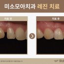 미소나래치과의원 이미지