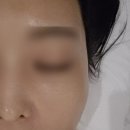 온비움 | 의정부 피부관리 비움에스테틱에서 웨딩관리받고 온 후기