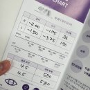 일오약국 | 인천 구월동 안과 직장인 스마일라식 내돈내산 후기