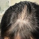 400 | 바이브랩 스피옥실 400 후기 내돈내산 사용법 효과 3개월