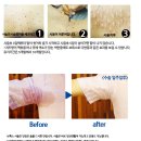 엘젠느의원 네이버블로그