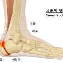 "발 뒤꿈치 들기" 운동. 이미지